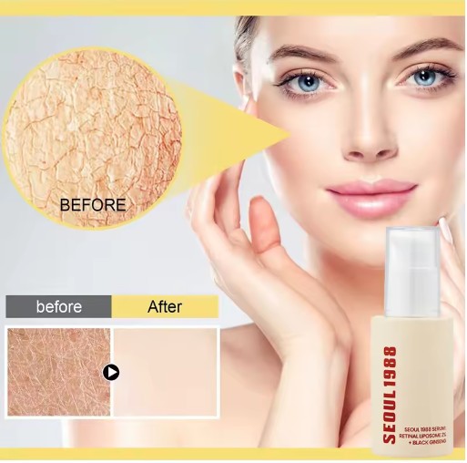 KSEOUL 1988 Erase Wrinkles. Restore Glow. Fast